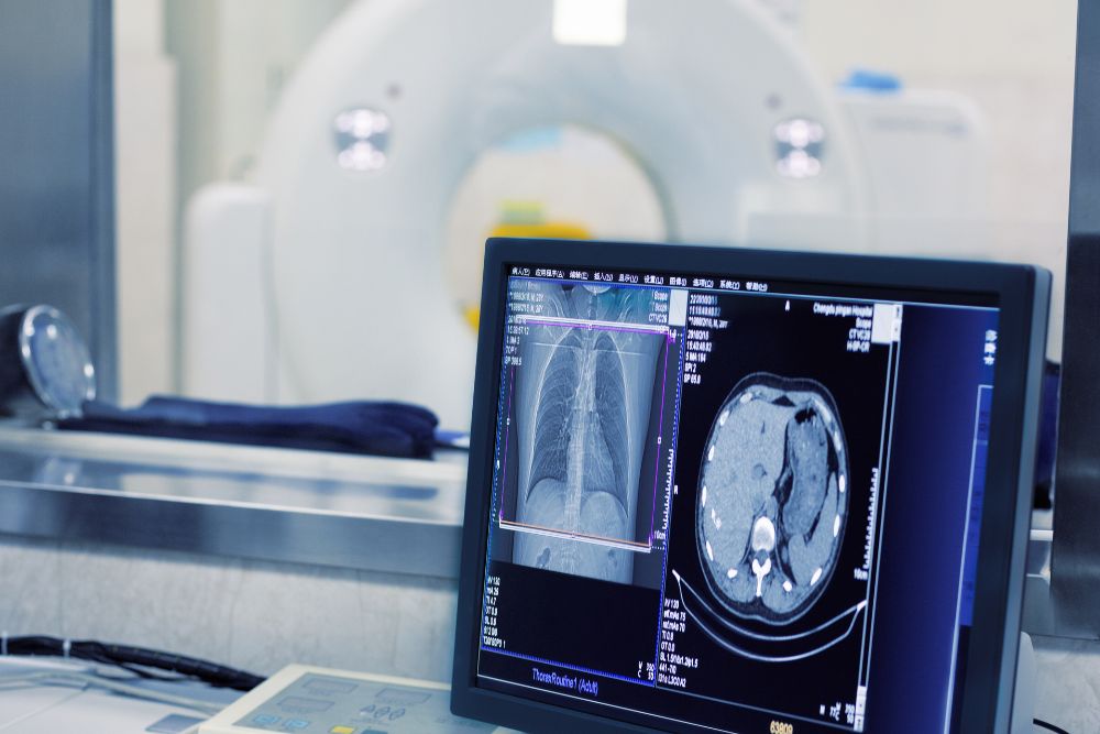 Estudiar Radiología en Valladolid
